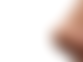 Patient Experiences Non-Surgical Nose Jobs in Dubai