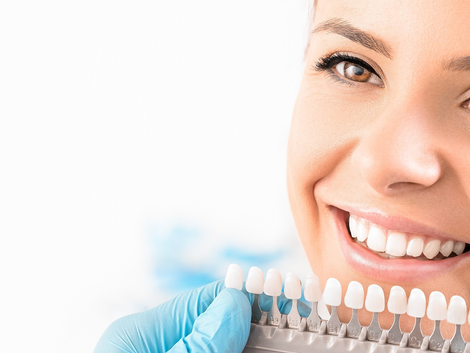 How Much Do Composite Veneers Cost in Dubai? A Comprehensive Breakdown