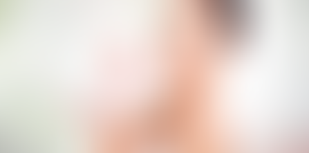 From Consultation to Results Navigating Permanent Skin Whitening in Dubai