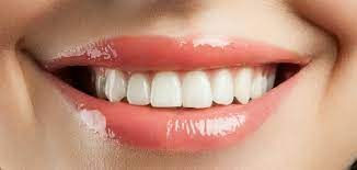 Affordable Teeth Whitening Options in Dubai