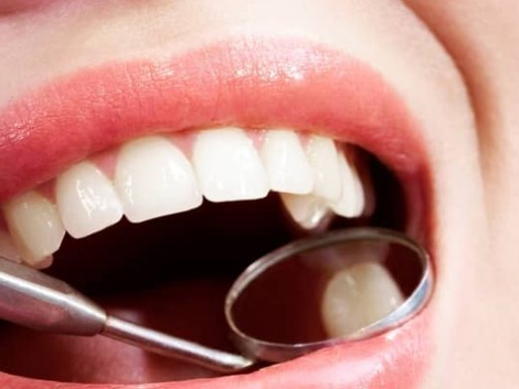 How Much Do Tooth Fillings Cost in Dubai? A Detailed Analysis