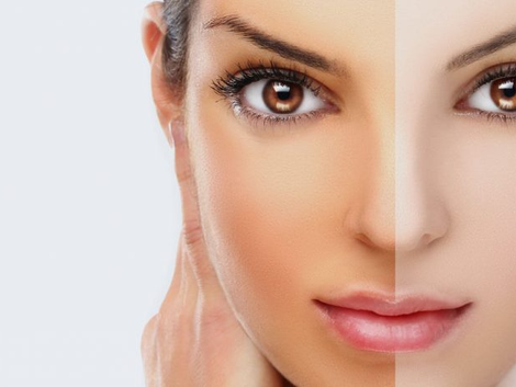 Comparative Analysis of Permanent Skin Whitening Treatments in Dubai Costs and Effectiveness