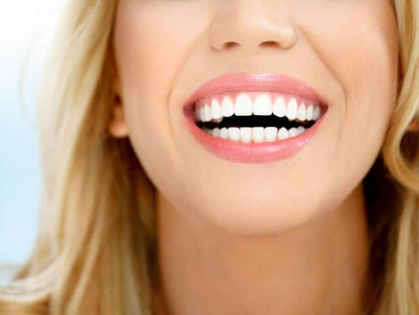 Dubai Teeth Whitening Costs for In-Office vs. At-Home Treatments