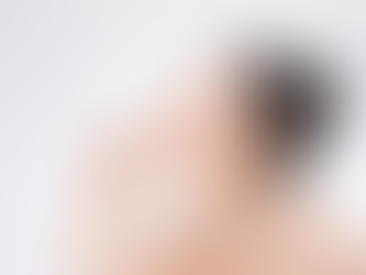 Hiko Nose Thread Lift vs. Traditional Rhinoplasty Which is Right for You?