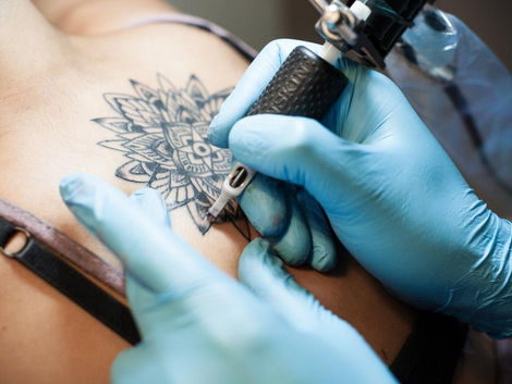 Picosure Tattoo Removal vs. Traditional Methods Dubai’s Best Option