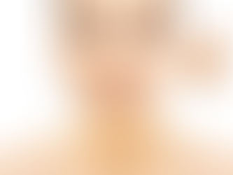 Pico Laser Treatment in Dubai Benefits and Results Explained