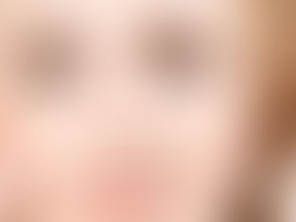The Benefits of Juvederm Fillers Achieve a Youthful Appearance in Dubai