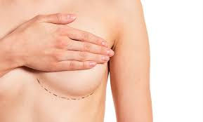 Breaking Down the Expenses of Gynecomastia Surgery in Dubai
