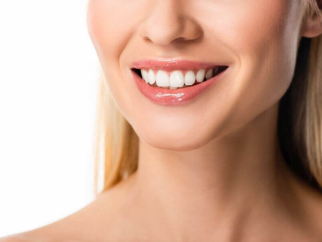 The Advantages of Composite Veneers Why Dubai Residents Are Choosing This Option