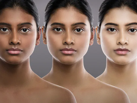 A Closer Look at Popular Permanent Skin Whitening Methods Available in Dubai
