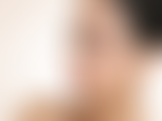 Factors Influencing Facelift Surgery Prices in Dubai