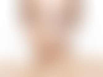 Facelift Surgery in Dubai Factors Influencing the Cost