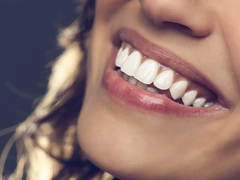 Top Clinics for Composite Veneers in Dubai Finding the Best Care