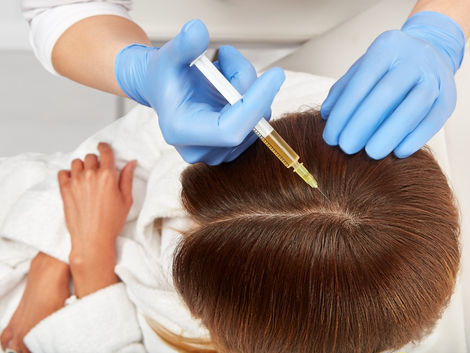 Breaking Down PRP Treatment Costs in Dubai Session by Session