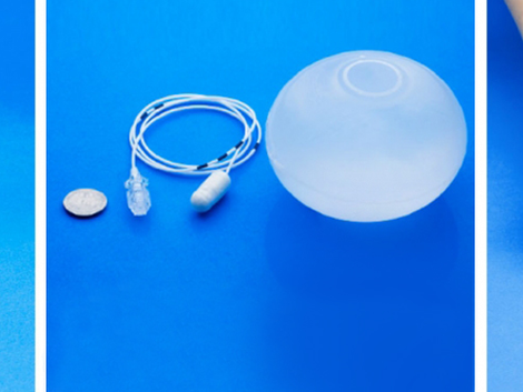 Factors Influencing the Cost of the Allurion Balloon in Dubai