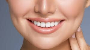How Much Do Dental Veneers Cost in Dubai?