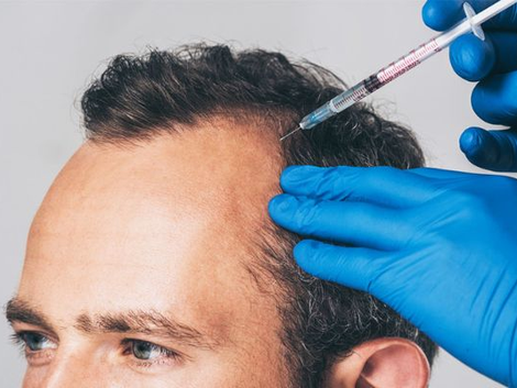 Factors Influencing the Cost of PRP Treatment in Dubai