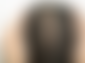 Reversing Hair Loss The Latest Treatments Available in Dubai