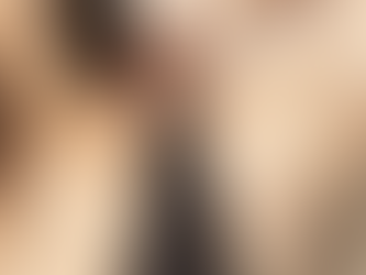 Underarm Whitening in Dubai Benefits and Popular Procedures