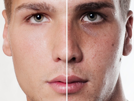 A Comprehensive Guide to Permanent Skin Whitening Treatments Available in Dubai