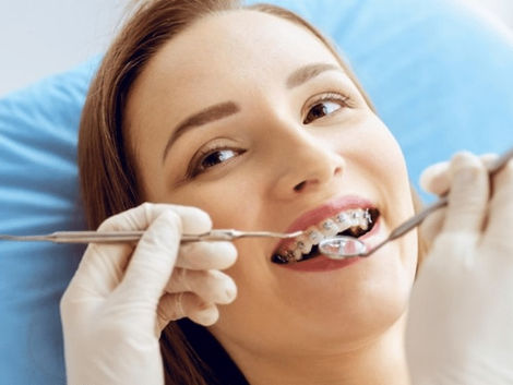 Affordable Tooth Filling Options in Dubai Your Budgeting Guide