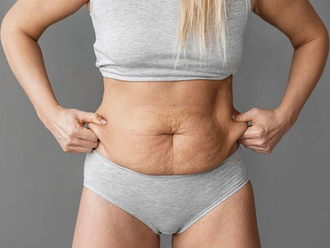 Exploring the Benefits of Tummy Tuck Surgery in Dubai