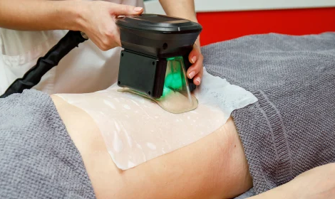 CoolSculpting Cost in Dubai Is It Worth the Investment?