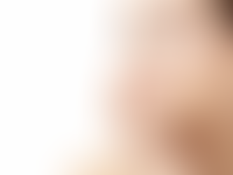 Juvederm Fillers in Dubai Costs, Benefits, and Expectations