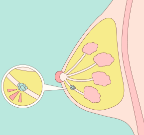乳癌年輕化趨勢下的挑戰:三陰性乳癌與好發族群解析