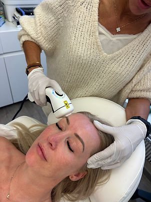 Thermage Hautstraffung Behandlung bei Skinembrace