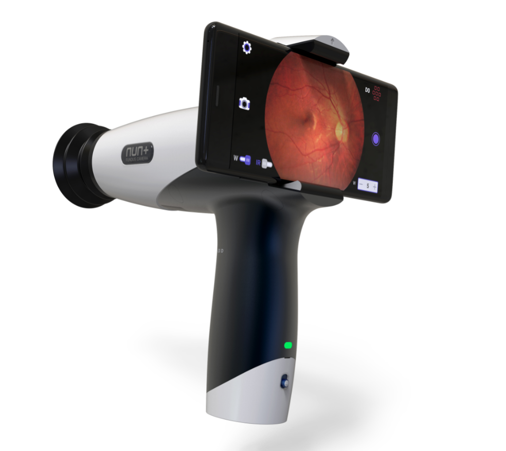 Cámara Retinal - Nun+