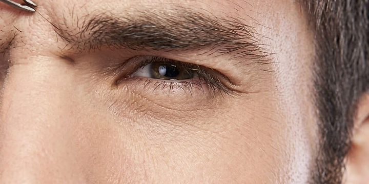 Épilation du visage