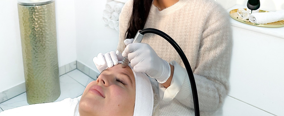 MICRODERMABRASION.