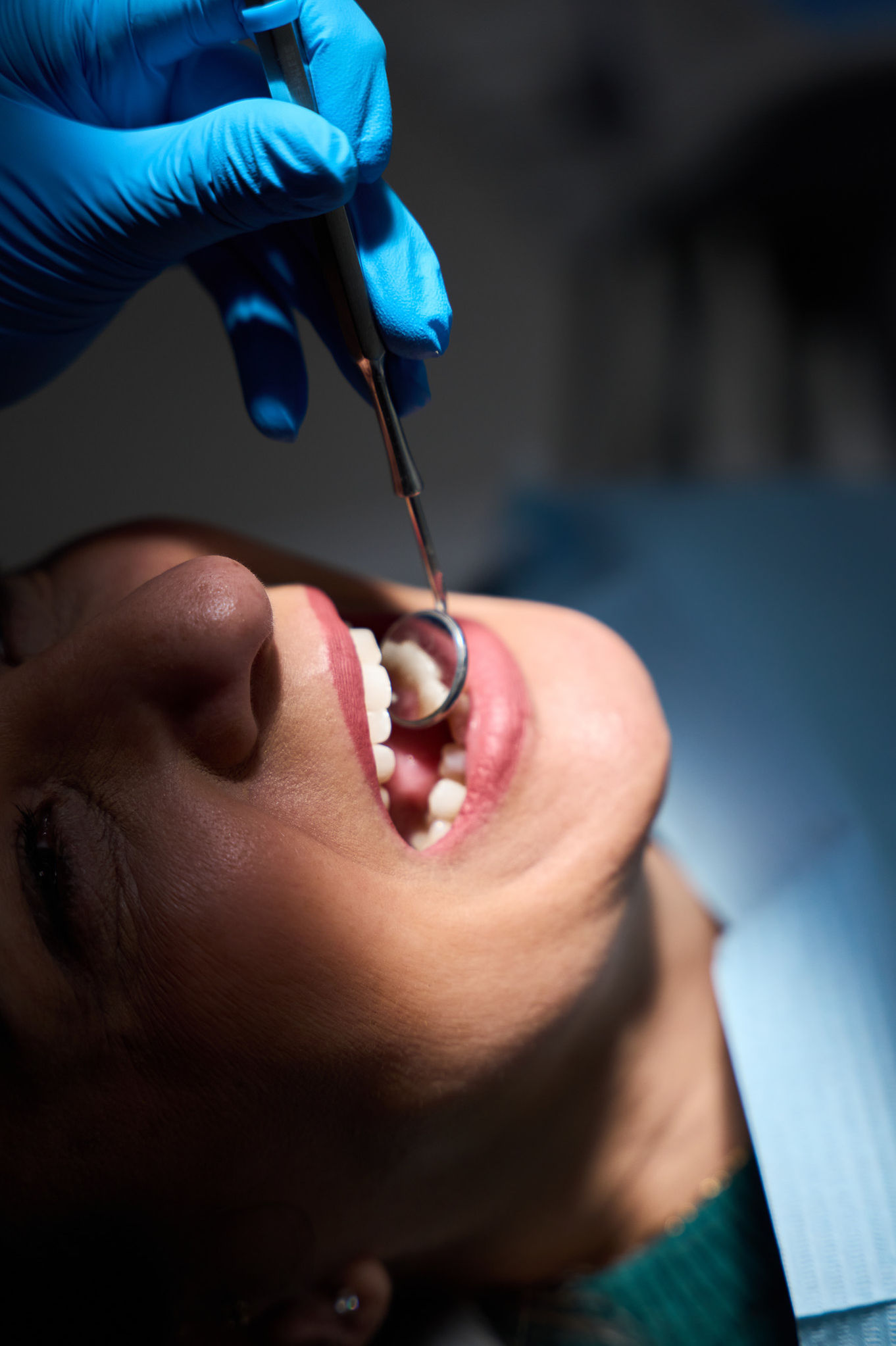 Dental check-up with mirror and gloved hand.