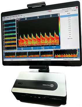 Transcranail Doppler (TCD) Tablet Based and Wire Free