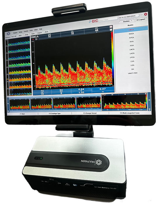 Transcranial Doppler-Wire Free Tablet Based