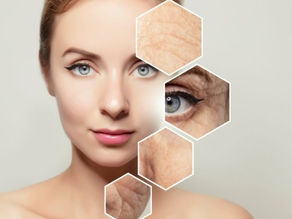 Anti Aging Pflege - wie die Haut altert