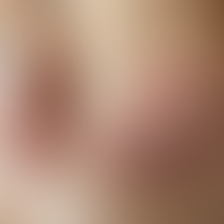 Prevent Ingrown Hairs Tips: How to Keep Your Skin Smooth After Waxing