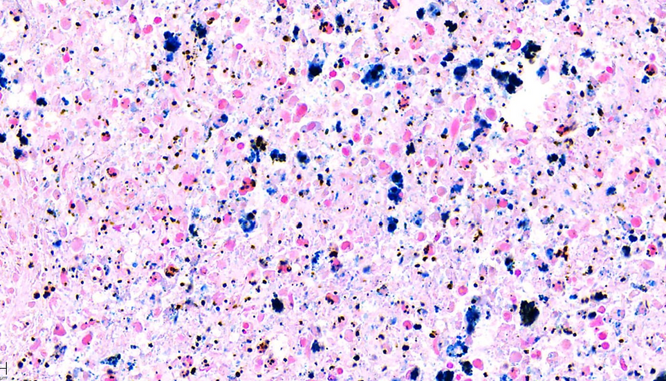 Prussian Blue Stain