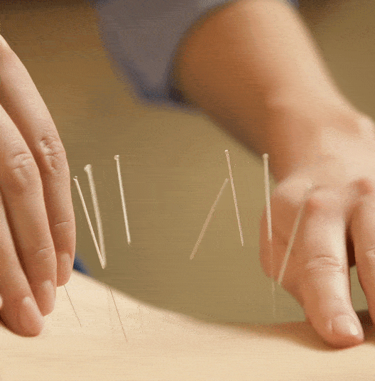 Elephant-Acupuncture-Web-Square.gif