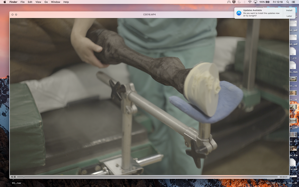 Operating Table