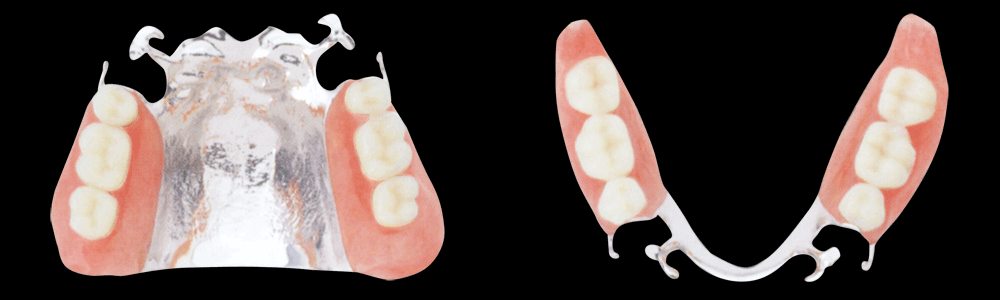 わかすぎ歯科クリニックメタルプレート