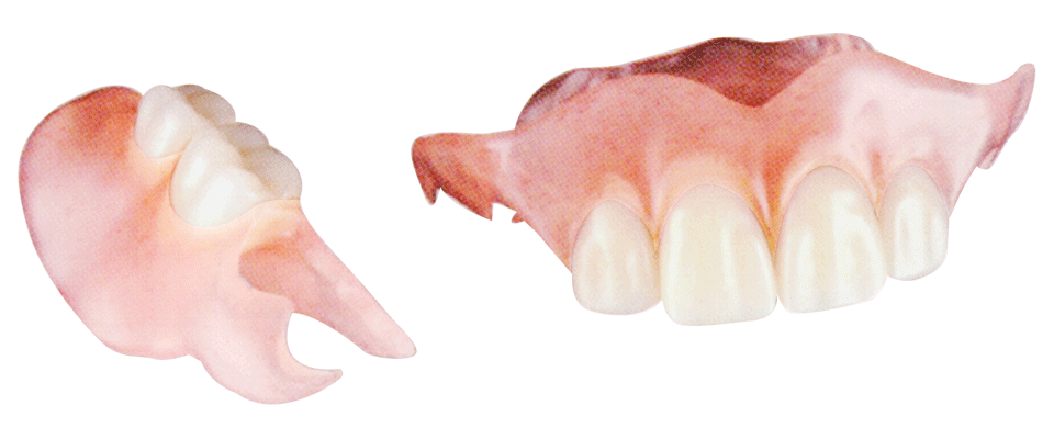 わかすぎ歯科クリニックスマートデンチャー