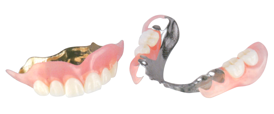 わかすぎ歯科クリニックメタルプレート