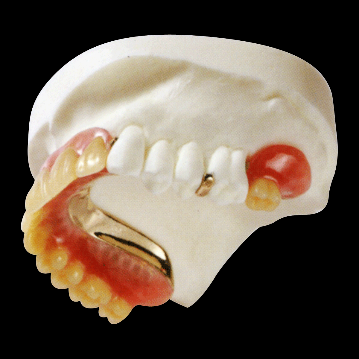 わかすぎ歯科クリニックミラクルデンチャー