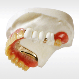 わかすぎ歯科クリニックミラクルデンチャー