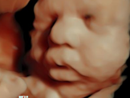 Due Before 2027? Now Is the Perfect Time to Plan Your 3D Ultrasound