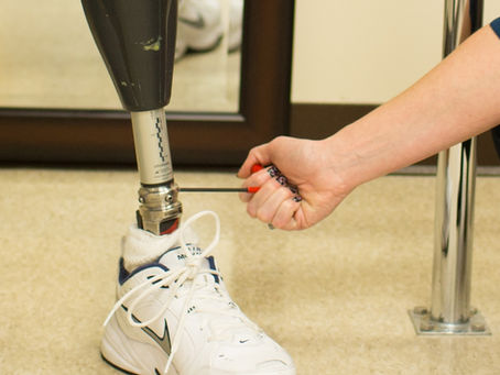 How Prosthetic Alignment Affects Comfort and Mobility