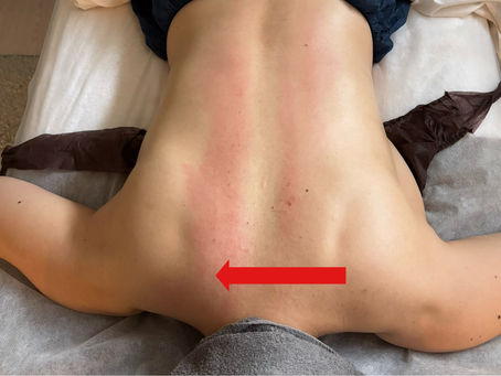 【湘南藤沢】背中からほぐすツヤ肌フェイシャル