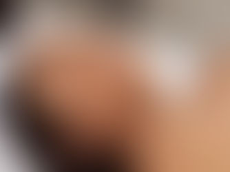 I'm Aging Backwards After a NeoGen Non-Surgical Facelift